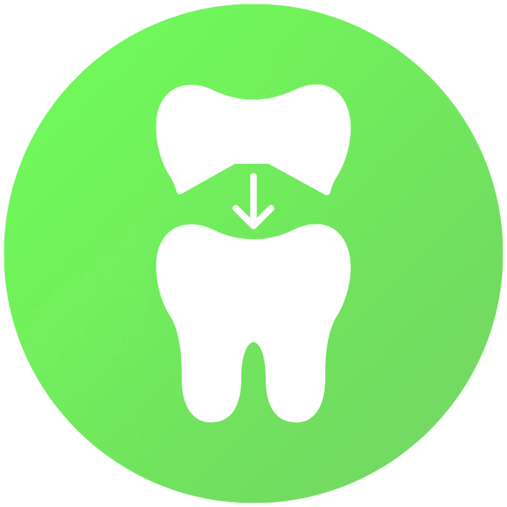 Illustration of a dental veneer being placed on a tooth to enhance appearance and restore shape