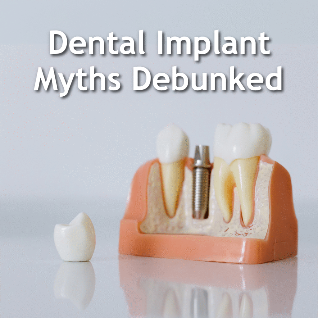 A dental implant model showing the titanium post and crown used to replace a missing tooth, illustrating common dental implant myths.