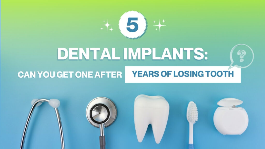 Dental implants after tooth loss: can you get an implant years after losing a tooth?