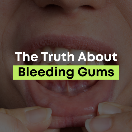 The truth about bleeding gums