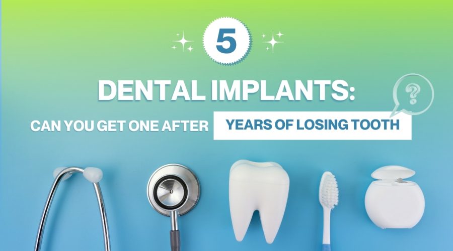 Dental implants after tooth loss: can you get an implant years after losing a tooth?