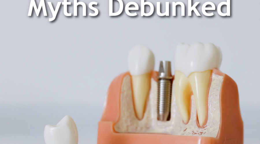 A dental implant model showing the titanium post and crown used to replace a missing tooth, illustrating common dental implant myths.