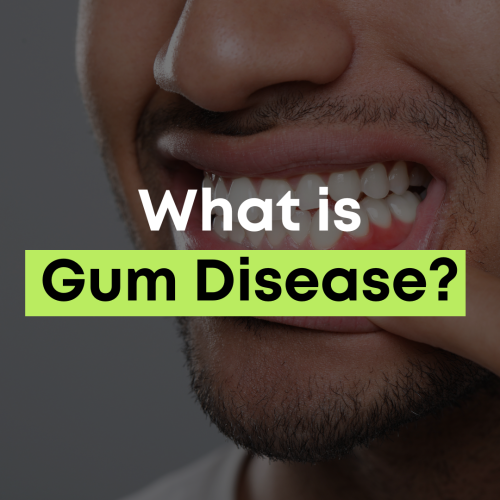What is gum disease