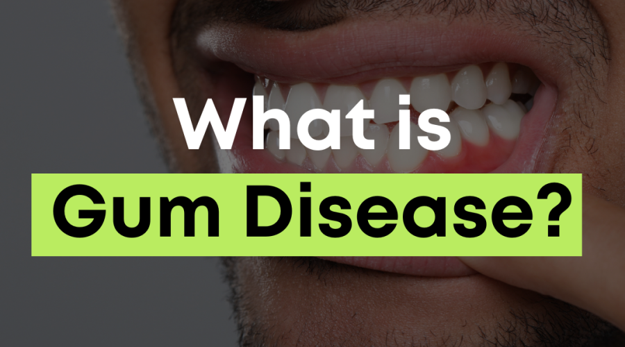 Man smiling and showing his teeth representing an educational graphic about what gum disease is