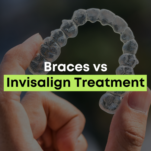 Braces vs Invisalign Treatment